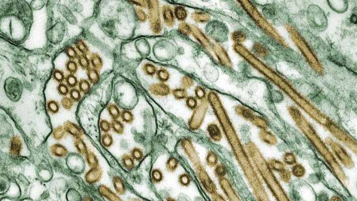 Colorized electron micrograph of H5N1 avian influenza virus particles (gold) inside infected cells (green)